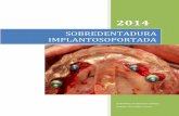 SOBREDENTADURA IMPLANTOSOPORTADA · PDF file1 SOBREDENTADURA IMPLANTOSOPORTADA 2014 la estabilidad están compartidos entre la mucosa y los implantes. PRESENTACIÓN DEL CASO Paciente