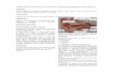 Papel de la TCMD en la valoración de la patología del oído ...seram2010.seram.es/modules/posters/files/papel_de_la_tcmd_en_la... · Papel de la TCMD en la valoración de la patología