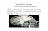C E ERREBBELLOO - fmed.uba.ar · PDF fileEl cerebelo se encuentra unido al tronco encefálico a través de los pedúnculos cerebelosos, que son 3 estructuras pares: El