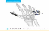 Técnica quirúrgica - Acumed | Innovation With Purpose³n de la barra Tornillo de fijación 3 PREPARACIÓN La unidad del alojamiento para huesos pequeños (SM-5100) se fija a las