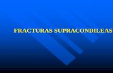 FRACTURAS SUPRACONDILEAS - medicina.uanl.mx · FRACTURAS SUPRACONDILEAS ETIOLOGIA: La hiperextension del codo predispone a las fracturas supracondileas en niños. La remodelacion
