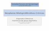 Neoplasias)Mieloproliferavas )Crónicas) - SPHsph-peru.org/wp-content/uploads/2016/01/expo-empc-sph1.pdf · Neoplasias)Mieloproliferavas )Crónicas) ... Hidronefrosis Quistes renales