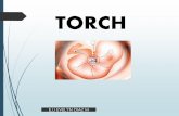 Presentación de PowerPoint - central de apuntes · TORCH Es una infección materna que afecta al feto en gestación. Este síndrome corresponde a un conjunto de signos y síntomas