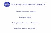 SOCIETAT CATALANA DE CIRURGIA - acmcb.es · -Limfoma - Sarcoma intratiroïdal (molt rar) ... Transformació maligna de les cèl·lules epitelials SOCIETAT CATALANA DE CIRURGIA Patogènesi