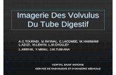 Imagerie Des Volvulus Du Tube Digestifpe.sfrnet.org/Data/ModuleConsultationPoster/pdf/2008/1/87055b23... · EMC Malformations congénitales du tube digestif à l’étage thoracique,