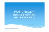 MONITORIZACIÓN NEUROFISIOLÓGICA … · ‐Excesiva corrección de la curvatura de la columna ... la vía visual desde la retina hasta el córtex occipital.