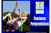 Paula Isabel Fernández Vega. DUE Qx COT H. U. … · •La fractura periprotésica. Clasificación. • Fracturas de cadera periprotésicas • Fracturas de rodilla periprotésicas