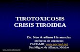 TIROTOXICOSIS CRISIS TIROIDEA · • El hipertiroidismo afecta 1.9% de la población femenina y una décima parte de esa cifra son varones.