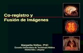 Co-registro y Fusión de Imágenes - Human Health … · Escuela Universitaria de Tecnología Médica Montevideo, Uruguay . Qué tan importante es el co-registro de imágenes en MN?
