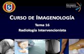 Curso de Imagenología - medicina.uanl.mx · TB (+ aspergilosis) Bronquiectasias Fibrosis quística Tumores Malformaciones vasculares Origen: Arterias bronquiales: 90%