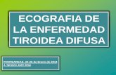 ECOGRAFIA DEL ECOGRAFIA DE TIROIDES LA …policlinicosanmiguel.com/wp-content/uploads/2013/12/ECOGRAFIA-DE... · -SIN HILIO -MAS EN EL LADO IZQUIERDO Y ... -Asociación demostrada