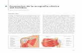 Escenarios de la ecografía clínica del hombro€¦ · El dolor de hombro es una causa frecuente en la consulta en Atención Primaria ... (tendinopatías, artritis-artrosis acromioclavi-cular,