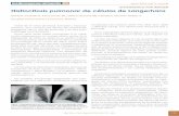DIAGNÓSTICO POR IMAGEN Histiocitosis pulmonar de células ...mgyf.org/wp-content/uploads/2017/revistas_antes/V3N6/V3N6_175_183… · de histiocitosis de células de Langerhans. Se