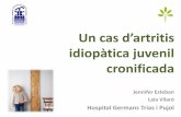 idiopàtica juvenil - academia.cat · Dona, 36 anys Antecedents patològics 1985 (7 anys) artritis idiopàtica juvenil sistèmica (AIJs) Bronquitis asmàtica Hipersòmnia diürna