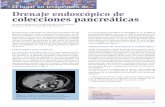 El lugar en terapéutica de Drenaje endoscópico de ...aeeh.es/wp-content/uploads/2012/05/v8n3a545pdf001.pdf · Indicaciones de tratamiento endoscópico ... B. Prótesis plástica