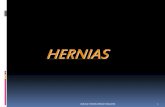 HERNIAS - ecaths1.s3.amazonaws.comecaths1.s3.amazonaws.com/tecnicasquirurgicas1/HERNIAS.pdf · DE LAS HERNIAS ABDOMINALES El tratamiento quirúrgico se realiza en cuatro pasos: 1-