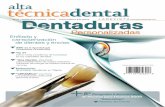 técnica alta dental técnicadental - denturewin.com · Enfilado y caracterización de dientes y encías Personalizadas ... Subasta Dental “Una Opción, 2da.Parte para el tratamiento