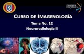 Curso de Imagenología - medicina.uanl.mx · Lesiones extra-axiales Hematoma Subdural Hematoma Epidural ...