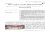 reporte clínico Membrana de fibrina versus injerto ... · Alumno post-título especialidad en Periodoncia, ... desarrollada en Francia por Choukroun et al ... el paladar se suturó