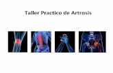Taller Practico de Artrosis - Portal del Departament d'Alcoi Artrosis_Enf.pdf · caracterizada por un deterioro progresivo del cartílago hialino ... • Estirado boca arriba: con