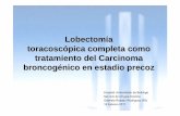 Lobectomía toracoscópica completa como tratamiento … · Pruebas complementarias •Broncoscopia flexible estándar Alteración de segmentación con bronquio accesorio en LM •Pruebas