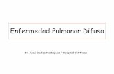 Enfermedad Pulmonar Difusa - SMS CHILE · Neumonia Intersticial no Específica NSIP ... (RILB) Neumonia Intersticial Linfocítica (LIP) Crónica • Neumonía Intersticial Usual (UIP)
