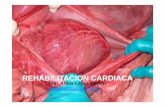 2015 rehabilitacion cardiaca.ppt [Modo de compatibilidad] · ‐Infarto de miocardio ‐Angina de esfuerzo estable ‐Tras cirugía coronaria • Trasplante cardíaco. • Cirugía