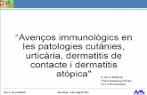  · Conectivopatías (lupus eritematoso). Procesos linfoproliferativos. Presencia autoanticuerpos (30-70%): Antitiroideos. Antinucleares Anti-lgE & anti-Fct RI.