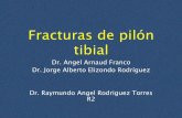 Fracturas de pilón tibial - Inicio | Facultad de Medicina … · 2015-09-21 · • Asociadas a lesiones en miembro inferior ipsi, ... • la fractura del peroné se asocia a fracturas