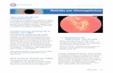 Retinitis por citomegalovirus - saeye.com · retina y dana el nervio 6ptico. Esto produce ceguera. Las personas con retinitis por CMV con frecuencia presentan retina desprendida.