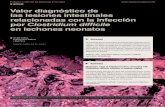 Valor diagnóstico de las lesiones intestinales …ivis.org/journals/suis/79/1.pdf · Erosión epitelial superficial, infiltrado de neutrófilos en lámina propia y exudado luminal