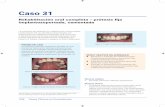 Rehabilitación oral completa – prótesis fija ...media.axon.es/pdf/88058_3.pdf · • Edentulismo parcial. ... total fija atornillada puede no ser una opción debido a ... •