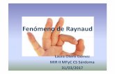 PwP Fenómeno de Raynaud · MIR II MFyC CS Sárdoma 31/03/2017. Fenómeno de Raynaud (FR) ... calentarse con aguda caliente... ejercicios con las manos…) – No fumar. ... ACROSÍNDROMES