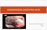 HEMORRAGIA DIGESTIVA ALTAs40dc24f18ab6a7e3.jimcontent.com/download/version... · Es toda pérdida de sangre procedente del tubo digestivo en sus tramos superiores, considerando ...