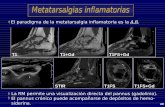 El paradigma de la metatarsalgia inflamatoria es la A.R.seram2010.seram.es/modules/posters/files/9._resultados_vi.pdf · La ecografía es una técnica excelente para identificarlos.