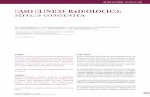 Caso clínico-radiológico: sífilis congénita · 2017-01-12 · presencia de hemorragia intraventricular (HIV) grado III bilateral (Figura 5) que se agrega a alteraciones observadas