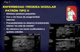 ENFERMEDAD TIROIDEA NODULAR PATRÓN TIPO Vseram2010.seram.es/modules/posters/files/figura58.pdf · La glándula tiroides esta típicamente aumentada de tamaño