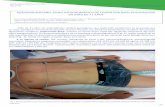 Revista Atalaya Medica nº 5 / 2014 D“‘’š ... · En nuestro caso tanto la descarga como la ... La Subluxación Rotatoria Atlanto-axial (SRAA) también conocida como Dislocación