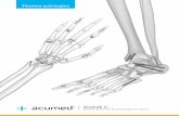 Técnica uirúrgica - acumed.net · la que los cirujanos abordan las fracturas, ... fémur, rótula, peroné, tibia, astrágalo, maléolo y calcáneo. Mano y muñeca Fusión de las