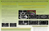 VALORACIÓN RADIOLÓGICA DE LA TROMBOSIS VENOSA …radiologiahumv.es/resumen/assets/comunicaciones_cientificas/... · Un conocimiento detallado de la anatomía del sistema venoso