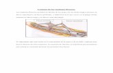 Lesiones de los tendones flexores - madridtrauma.com · pasiva según el protocolo de Duran, que es más sencillo y menos agresivo que el descrito previamente. Sistema de Kleinert
