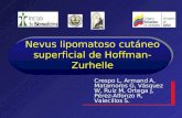 Nevus lipomatoso cutáneo superficial de Hoffman- Zurhelle · Nevus lipomatoso cutáneo superficial de Hoffman-Zurhelle Crespo L, Armand A, Matamoros G, Vásquez W, Ruíz M, Ortega