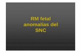 RM fetal anomal ías del SNC - seram2010.seram.esseram2010.seram.es/modules/posters/files/rm_fetal_corregida_snc... · En plano coronal se observa colpocefalia con disposición paralela