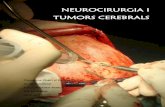 NEUROCIRURGIA I TUMORS CEREBRALS - …premisrecerca.udg.edu/Portals/0/CS/premis 2013/633-tdr-per-a-premi.pdf · Neurocirurgia i tumors cerebrals 6 1.1. OBJECTIUS Des d’un bon principi,