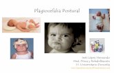 Plagiocefalia Postural - Asociación Vasca de Pediatría ... · “Plagio”cefalia: “oblicua, torcida o inclinada ... (asimetría facial) Palpación: fontanelas y suturas Columna
