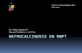 Nefrocalcinosis en RNPT - manuelosses.clmanuelosses.cl/BNN/docencia/Nefrocalcinosis en RNPT.pdf · Nefrocalcina? Tam Horsfall? Sin estudios. Inhibidores