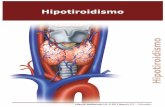 Hipotiroidismo - cursosiladiba · HIPoTIRoIDISMo 5 De otro lado, las células foliculares se tornan planas cuando la glándula se encuentra poco activa o inactiva, con aumento del