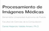 Procesamiento de Imágenes Médicas - cs.buap.mxdaniel.valdes/docs/PIM-MRI.pdf · gadolinio, un agente que causa una fuerte disminución del Tiempo de relajación T 1. •Imágenes