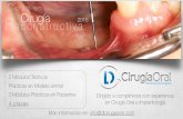 C urso en R Cirugía 2016 econstructiva - DL Oral Surgery · -Vestibuloplastia de Kazanjian Reconstrucciones Óseas: -Modelo Reconstructivo de Khoury -Atroﬁa horizontal en Frente