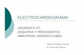 ELECTROCARDIOGRAMAELECTROCARDIOGRAMA v SEGMENTO ST. v ISQUEMIA Y PERICARDITIS. v ARRITMIAS VENTRICULARES. Saray Rodríguez García R1 Medicina interna.